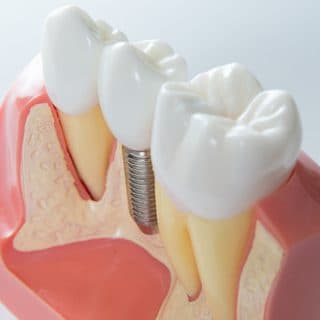 Implantologie / Orale Chirurgie