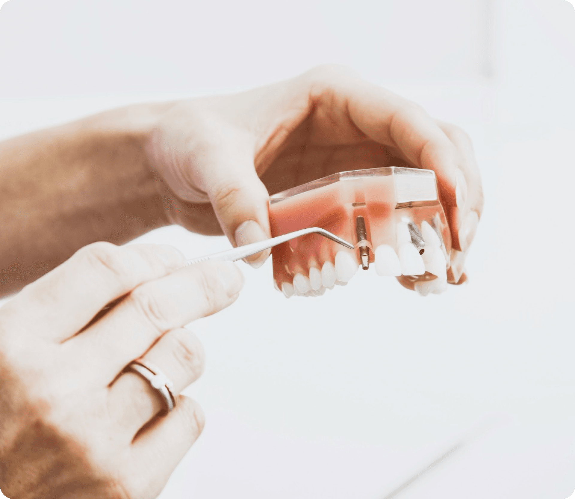 Implantologie / Orale Chirurgie